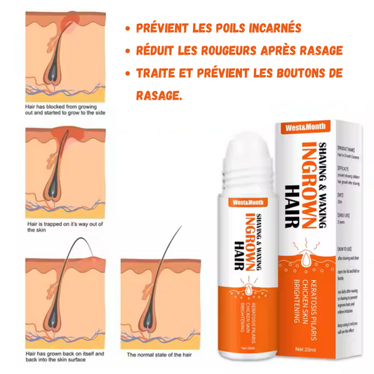 Ingrown Hair – Solution aux boutons de rasoir, poils incarnés et irritations après-rasage